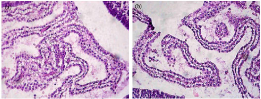 Image for - Microanatomical Study of the Maternal Diabetes Effects on Rat`s Choroids Plexus in Embryonic, Neonatal and Adulthood Stages