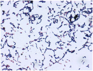 Image for - Pathogenic Bacteria Predominate in the Oral Cavity of Malaysian Subjects