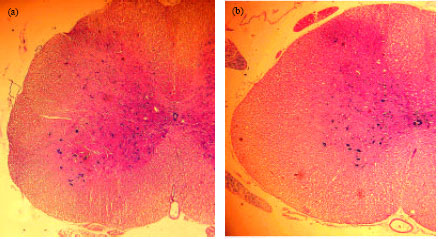 Image for - The Effect of Exogenous Testosterone Administration on Peripheral Nerves Regeneration after Sciatic Nerve Compression in Rat