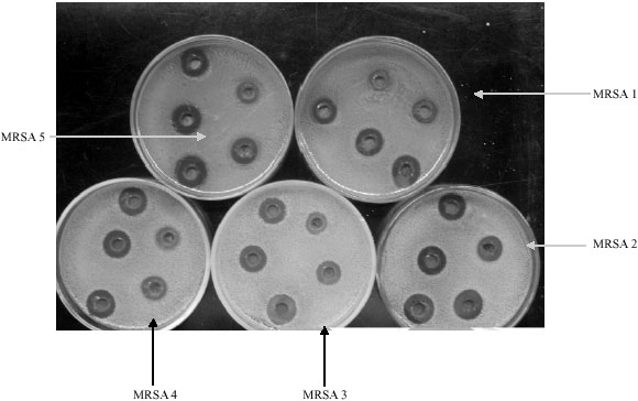 Image for - Phytochemical Analysis and Antibacterial Activity of Khaya grandifoliola  Stem Bark