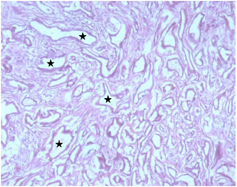 Image for - Grading in Canine Mammary Gland Carcinoma