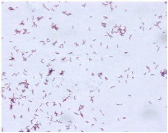 Image for - Pathogenic Bacteria Predominate in the Oral Cavity of Malaysian Subjects