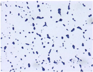 predominate malaysian pathogenic cavity gram aureus staphylococcus