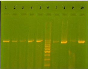 Image for - Spread of Extended-Spectrum Beta-Lactamase Producing Escherichia coli Clinical Isolates in Sanandaj Hospitals