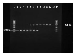 Image for - Detection of Shiga Toxin Producing E. coli Strains Isolated from Stool Samples of Patients with Diarrhea in Abadan Hospitals, Iran