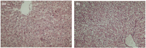 Image for - Hepatoprotective and Antioxidant Effect of Andrographis echioides N. against Acetaminophen Induced Hepatotoxicity in Rats