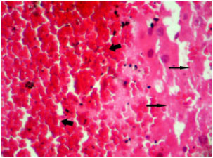 Image for - Biochemical and Pathological Study of Protective Effect of Vitamin E in Azathioprine-Induced Hepatotoxicity in Rat