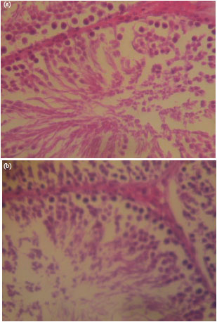 Image for - Effect of a Long Term Consumption of a Diet Supplemented with Leaves of 
  Gongronema latifolium Benth. on Some Biochemical and Histological Parameters 
  in Male Albino Rats