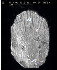 Image for - Scale Morphology of Tank Goby Glossogobius giuris (Hamilton-Buchanan, 1822) (Perciformes: Gobiidae) using Scanning Electron Microscope