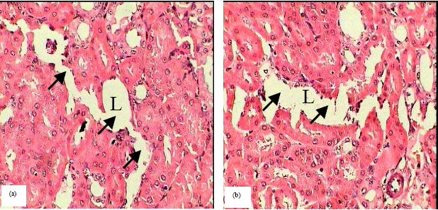 Image for - Histopathological Evidences of the Nephritic PathologicalAlterationsInduced by the Anabolic Androgenic Drug (Sustanon) in Male Guinea Pigs (Cavia porcellus)