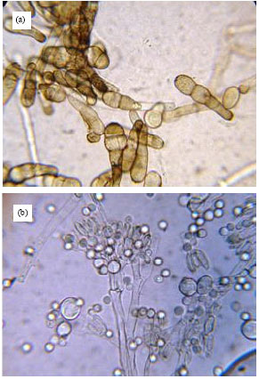 Image for - Isolation of Two Fungal Strains Capable of Phenol Biodegradation