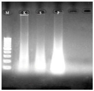 Image for - Comparison of the Three Methods for DNA Extraction from Paraffin-Embedded Tissues