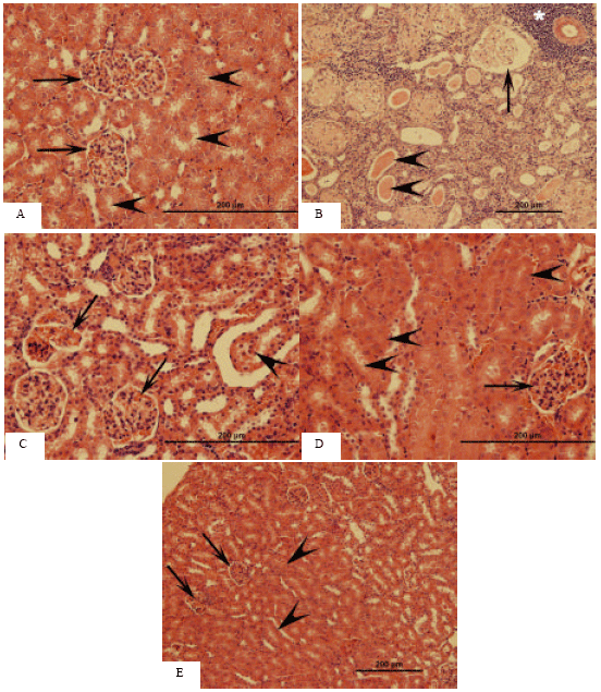 Image for - Renal Damage Mediated by Oxidative Stress in Mice Treated with Aluminium Chloride: Protective Effects of Taurine