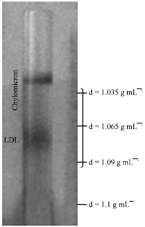 Image for - A Modification Method for Isolation and Acetylation of Low Density Lipoprotein of Human Plasma by Density Discontinuous Gradient Ultracentrifugatio