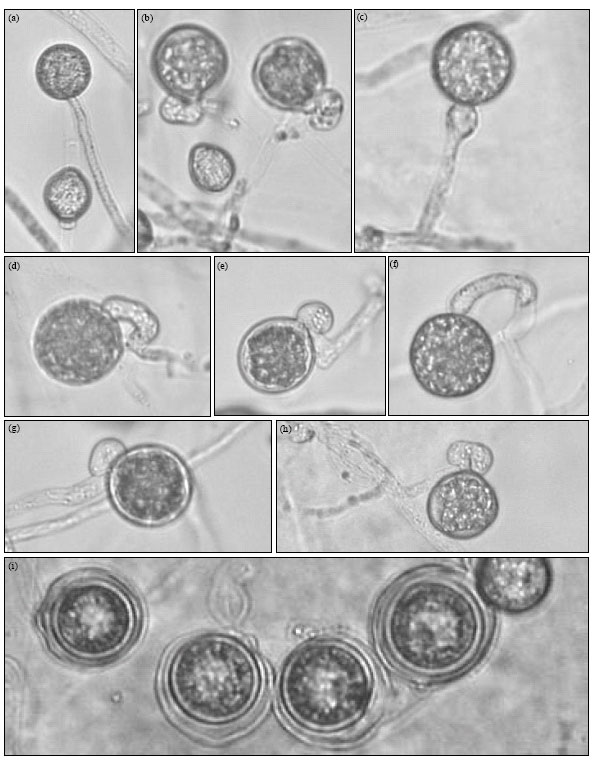 Image for - Differentiation Between Two Isolates of Pythium ultimum var. ultimum Isolated from Diseased Plants in Two Different Continents