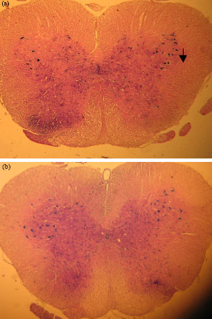 Image for - The Effects of Root Aquatic Extract of Salvia staminea on Neuronal Density of Alpha Motoneurons in Spinal Cord Anterior Horn after Sciatic Nerve Compression in Rats