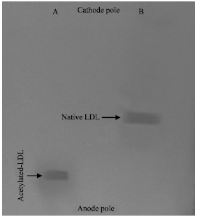 Image for - A Modification Method for Isolation and Acetylation of Low Density Lipoprotein of Human Plasma by Density Discontinuous Gradient Ultracentrifugatio