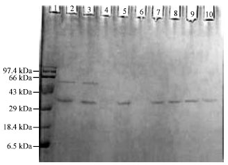 Image for - Purification and Characterization of an Extracellular Protease from Pseudomonas aeruginosa Isolated from East Calcutta Wetland