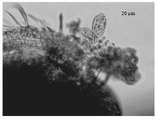 Image for - Presence of an Epibiont Epistylis niagarae (Protozoa, Ciliophora) on Mesocyclops aspericornis in Velachery Lake Chennai India