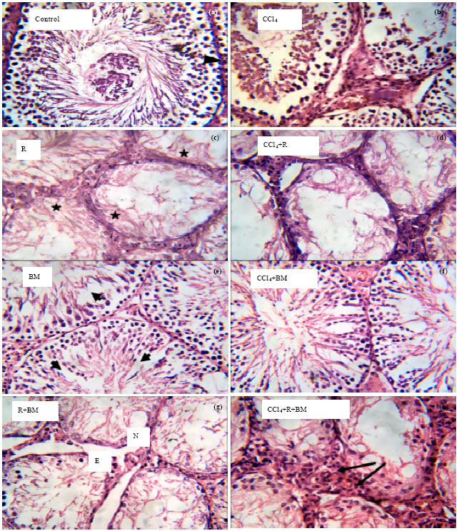 Image for - Low Doses of Gamma Radiation may Impair Testicular Tissue in a Rat Treated CCl4 Model: Role of BM Transplantation