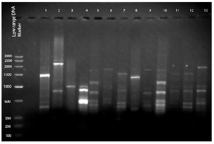 Image for - Enzymatic Screening and Random Amplified Polymorphic DNA Fingerprinting of Soil Streptomycetes Isolated from Wayanad District in Kerala, India