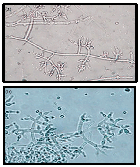 Image for - Occurrence and Microbiological Characteristics of Trichoderma in Al-Jabal Al-Akhdar Region, Libya