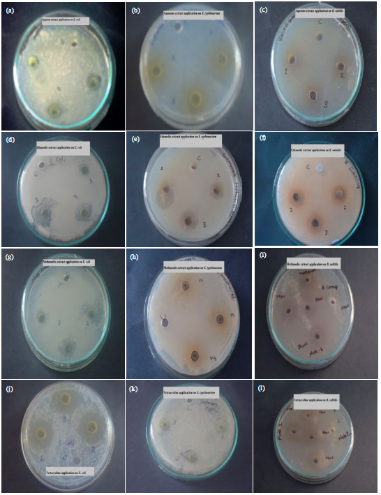 Image for - Antibacterial Activity of Atrichum undulatum (Hedw.) P. Beauv. Against Some Pathogenic Bacteria
