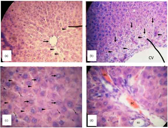 Image for - Enzyme Activity and Histopathology of Rat Liver Treated with Crude Methanolic Extract of Pepperomia pellucida (L.) HBK