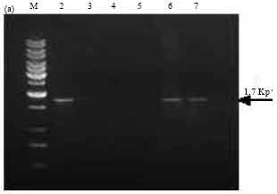Image for - Occurrence of cry Genes in Bacillus thuringiensis (Bt) Isolates Recovered from Phylloplanes of Crops Growing in the New Delhi Region of India and Toxicity Towards Diamond-back Moth (Plutella xylostella)
