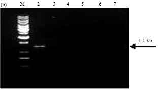 Image for - Occurrence of cry Genes in Bacillus thuringiensis (Bt) Isolates Recovered from Phylloplanes of Crops Growing in the New Delhi Region of India and Toxicity Towards Diamond-back Moth (Plutella xylostella)