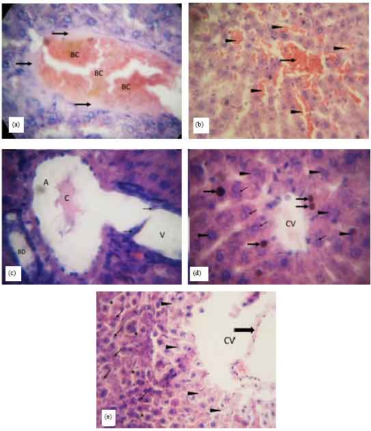 Image for - Enzyme Activity and Histopathology of Rat Liver Treated with Crude Methanolic Extract of Pepperomia pellucida (L.) HBK