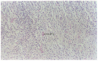 Image for - Erythrophoroma and Vertebral Dysplasia in Mystus gulio