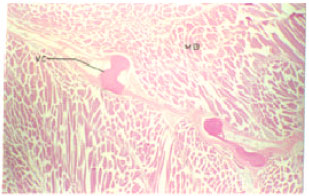 Image for - Erythrophoroma and Vertebral Dysplasia in Mystus gulio