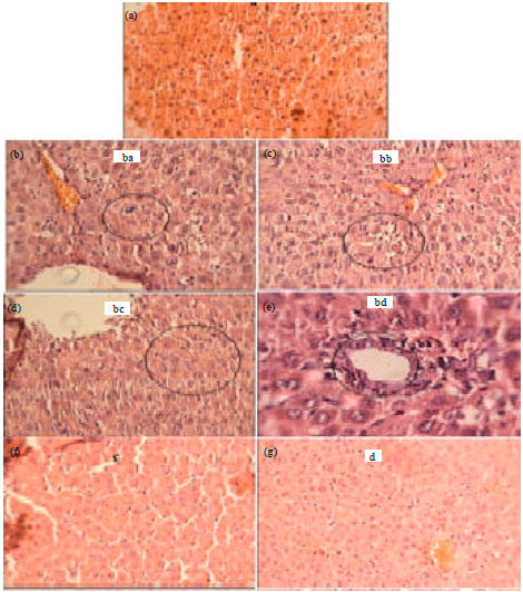 Image for - Protective Effect of Kombucha Tea on Liver Damage Induced by Thioacetamide in Rats