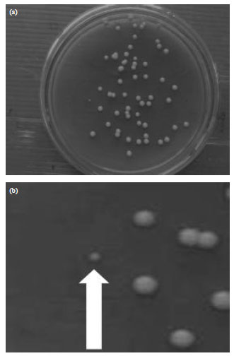 Image for - Antioxidant Activity of Flavonoid from Guazuma ulmifolia Lamk. Leaves and Apoptosis Induction in Yeast Cells