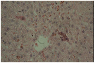 Image for - Acute Effect of Nanosilver to Function and Tissue Liver of Rat after Intraperitioneal Injection