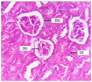 Image for - Acetaminophen Induced Kidney Failure in Rats: A Dose Response Study
