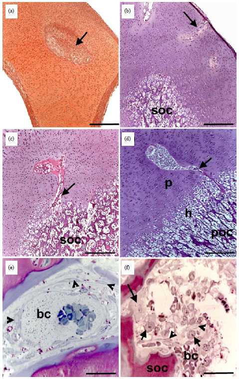 Image for - Histological Sequences of Long Bone Development in the New Zealand White Rabbits