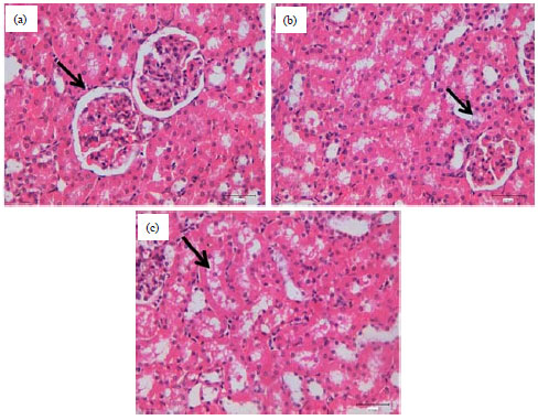 Image for - Gene Expression and Activities of Antioxidant Enzymes in Kidneys of Rats Intoxicated with Aflatoxin B1
