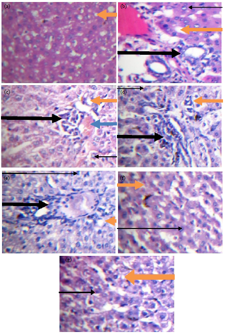 Image for - Acetaminophen Induces Mitochondrial Permeability Transition in Rats Without Causing Necrotic Liver Damage