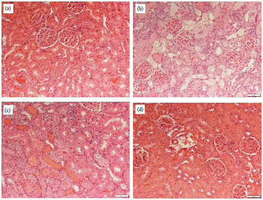 Image for - Beneficial Role of Quercetin on Echis coloratus Snake Venom Induced Hepato-renal Toxicity in Rats
