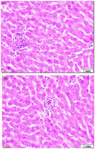 Image for - Hepatoprotective Effect of Methanolic Extracts of Prosopis farcta and Lycium shawii Against Carbon Tetrachloride-induced Hepatotoxicity in Rats