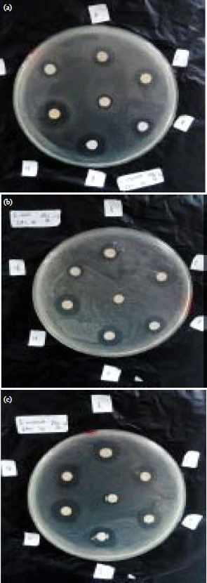Image for - Bioactivity of Fungi Trichoderma reesei Associated with Sponges Stylissa flabelliformis Collected from National Park West Bali, Indonesia