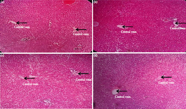 Image for - Hepatoprotective Activity of Pineapple (Ananas comosus) Juice on Isoniazid-induced Rats