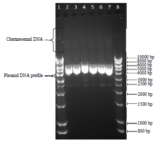 Image for - Investigation of Plasmid-Associated Fluoroquinolone Resistance in Nosocomial Pseudomonas aeruginosa Isolated from Infected Burn Wounds
