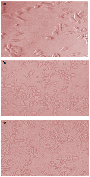 Image for - Influence of Vitamin E on Proliferation and Differentiation of Rat’s Dental Follicle Stem Cells Treated with Nicotine (An Experimental Study)