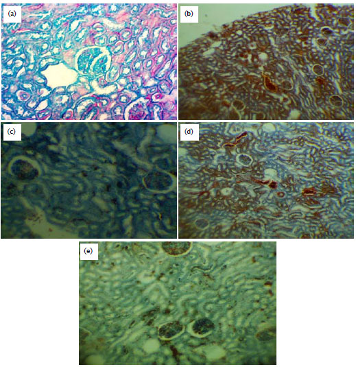 Image for - Therapeutic Effects of Parsley Extract in Streptozotocin-induced Gestational Diabetic Rats