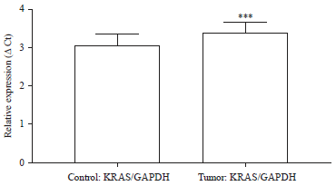 Image for - Molecular Investigation of KRAS Gene in Breast Cancer Patients