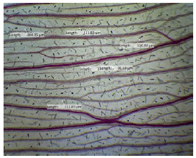 Image for - Role of Leaf Architecture for the Identification of agarwood-producing Species Aquilaria malaccensis Lam. and Gyrinops versteegii (Gilg.) Domke at Vegetative Stage
