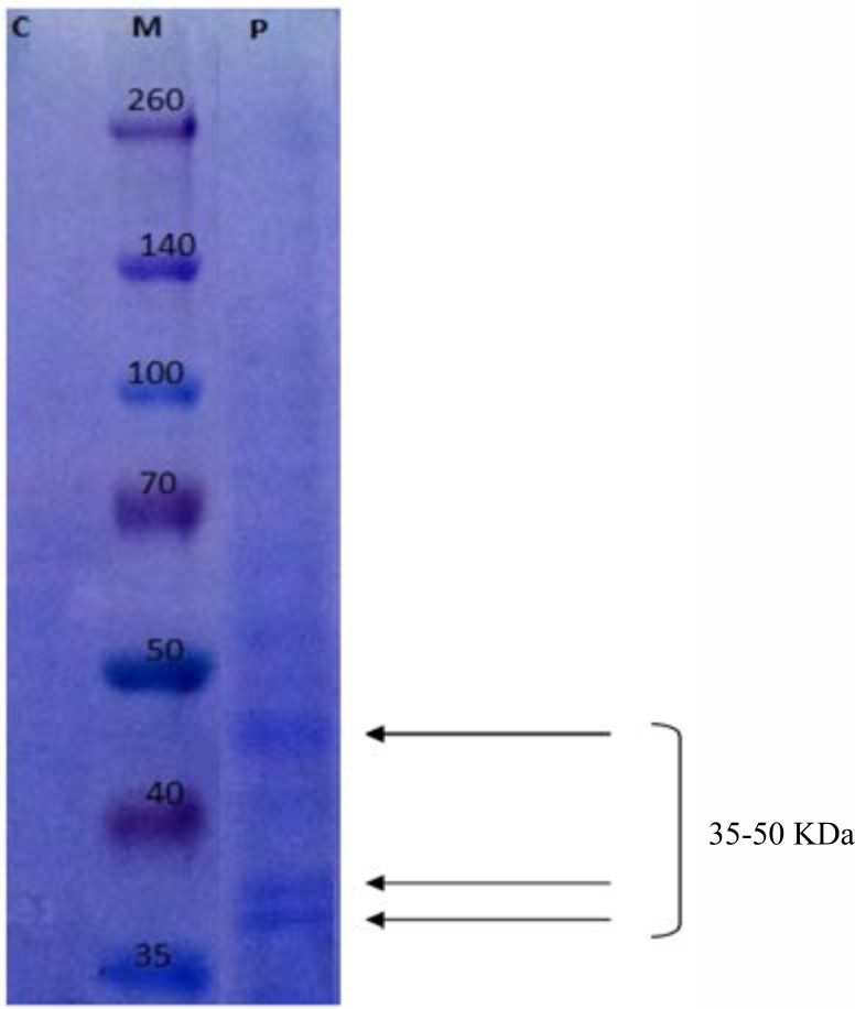Image for - Purification and Kinetics of Lipase of Pseudomonas fluorescens from Vegetable Oil Polluted Soil
